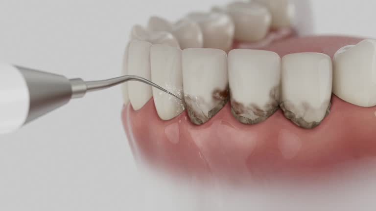 Reliable Dental Implants contractor in Thomasville, GA by Smile Center Dentistry
